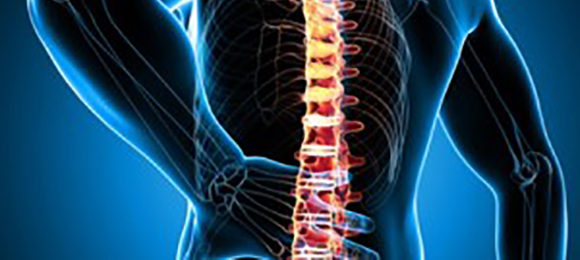 Improving care for spinal cord compression
